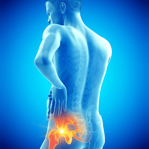 Mexico Hip Replacement: Canadians Save Big on Hip and Knee Surgery Abroad